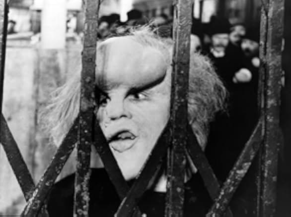 The Elephant Man 1980