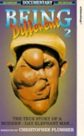 Being Different 1981