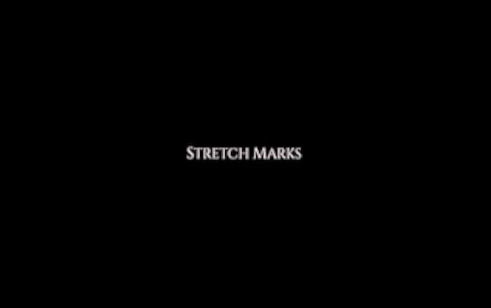 Stretch Marks 2018